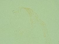 Pilatobius oculatus image