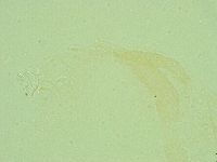 Pilatobius oculatus image