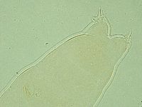 Pilatobius oculatus image