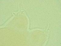 Pilatobius oculatus image