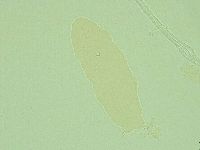 Pilatobius oculatus image