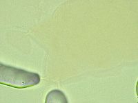 Pilatobius oculatus image