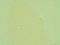 Pilatobius oculatus image