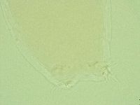 Pilatobius oculatus image