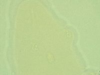 Pilatobius oculatus image