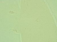 Pilatobius oculatus image