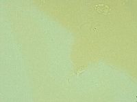 Pilatobius oculatus image