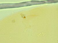 Pilatobius oculatus image