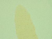 Pilatobius oculatus image