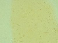 Pilatobius oculatus image