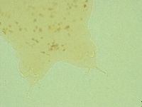 Pilatobius oculatus image