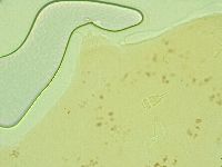 Pilatobius oculatus image
