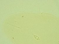 Pilatobius oculatus image