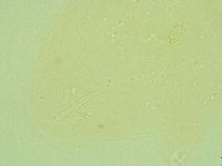Pilatobius oculatus image