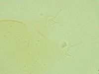 Pilatobius oculatus image