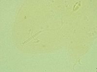 Pilatobius oculatus image
