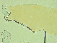 Pilatobius oculatus image