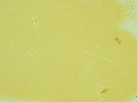 Pilatobius oculatus image