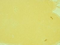 Pilatobius oculatus image