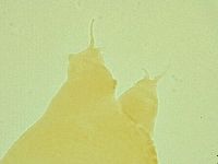 Pilatobius oculatus image