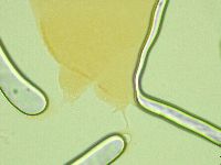 Pilatobius oculatus image