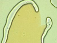 Pilatobius oculatus image
