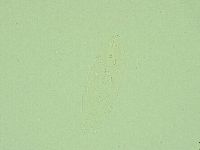 Hebesuncus conjungens image