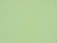 Hebesuncus conjungens image