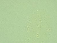 Hebesuncus conjungens image