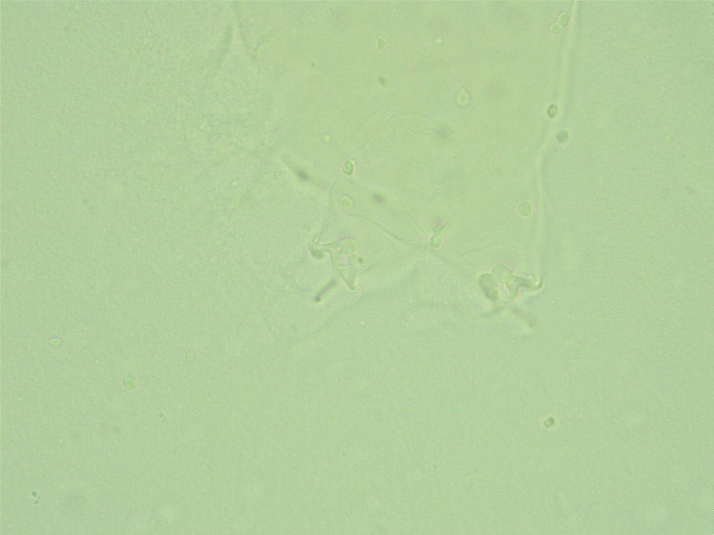 Hebesuncus conjungens image