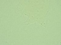 Hebesuncus conjungens image