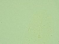 Hebesuncus conjungens image