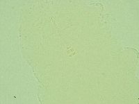 Hebesuncus conjungens image