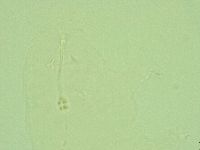 Hebesuncus conjungens image