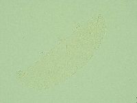 Hebesuncus conjungens image