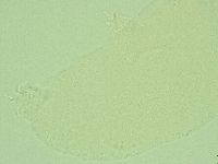 Hebesuncus conjungens image
