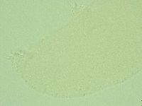 Hebesuncus conjungens image
