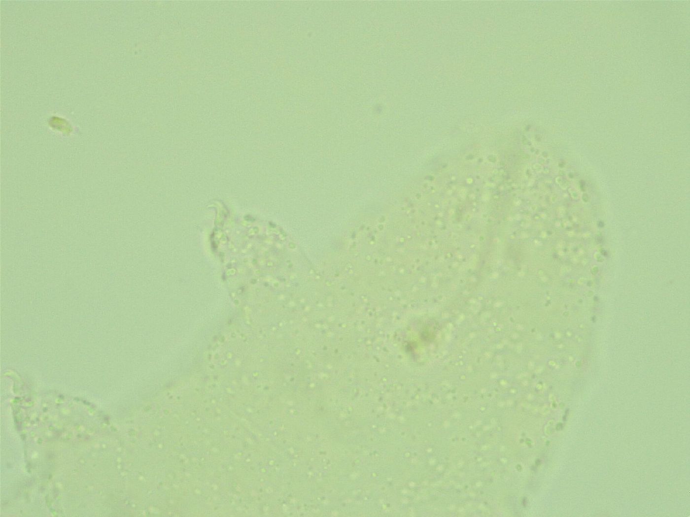 Hebesuncus conjungens image