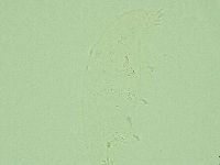 Hebesuncus conjungens image