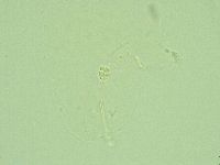 Hebesuncus conjungens image
