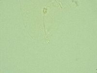 Hebesuncus conjungens image
