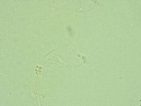 Hebesuncus conjungens image