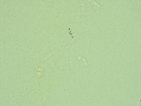Hebesuncus conjungens image