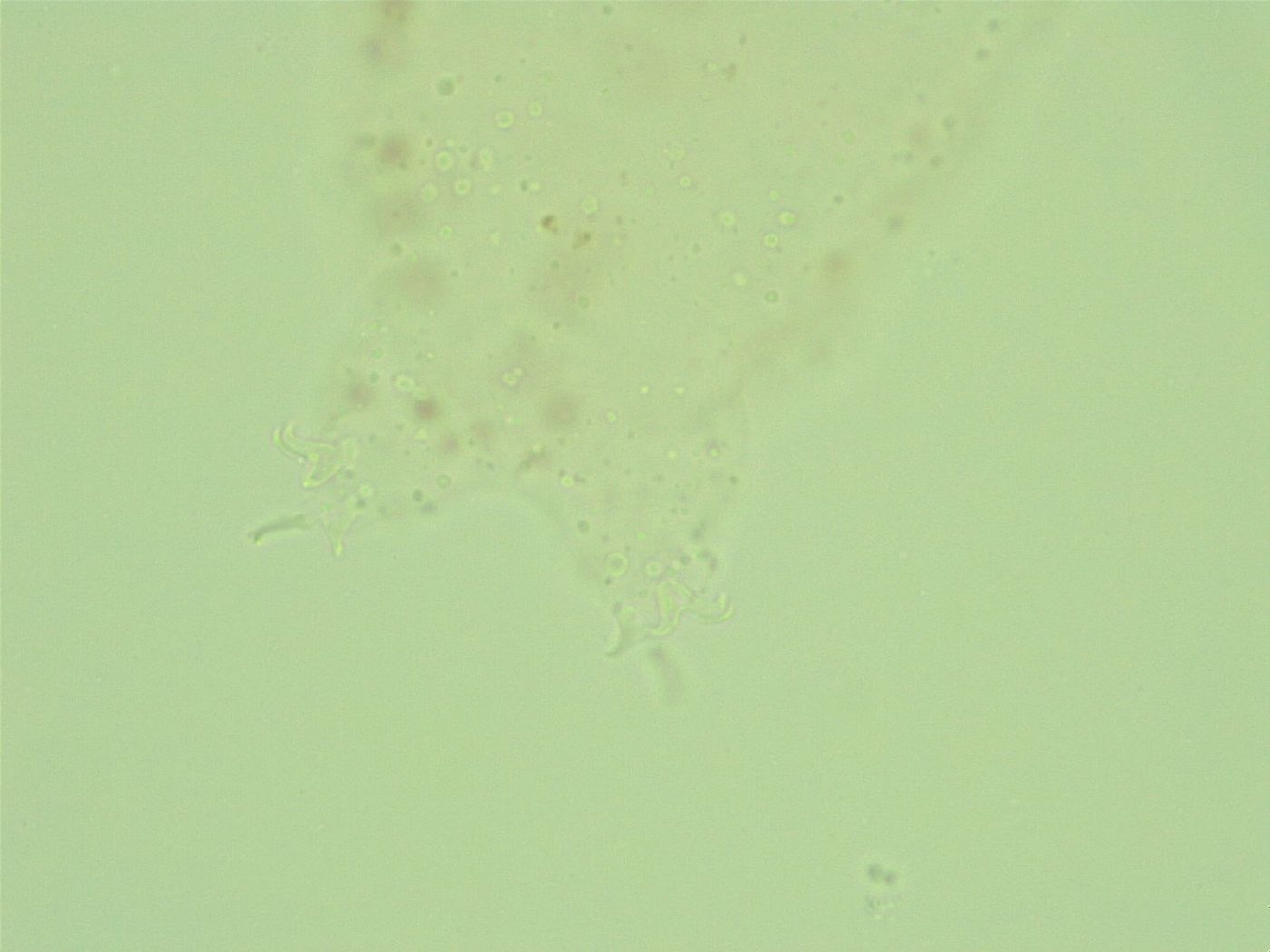 Hebesuncus conjungens image