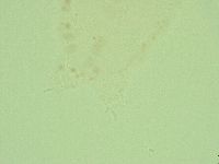 Hebesuncus conjungens image