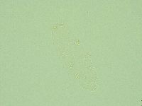 Hebesuncus conjungens image