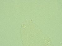 Hebesuncus conjungens image
