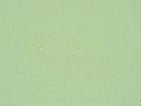 Hebesuncus conjungens image