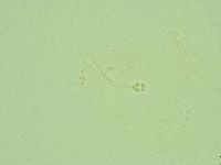 Hebesuncus conjungens image