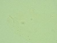 Hebesuncus conjungens image